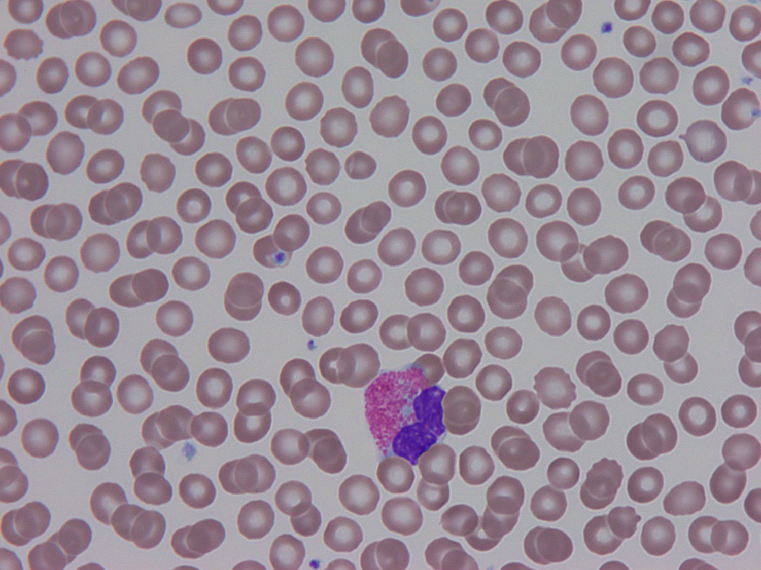 Peripheral blood smear under live AIMALABS analysis